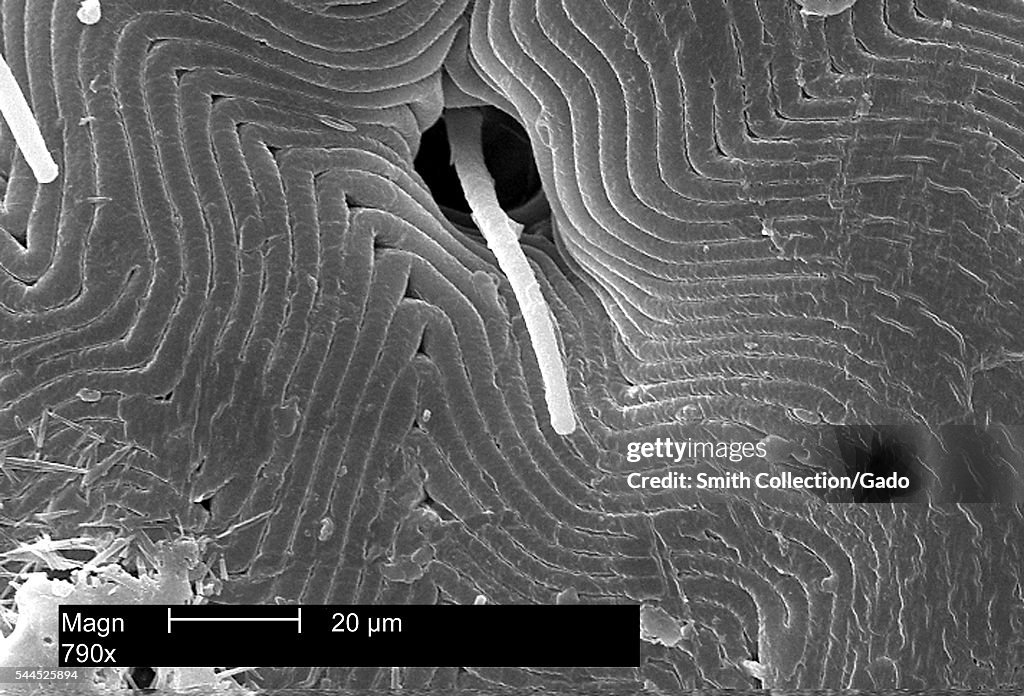 Dermacentor Variabilis