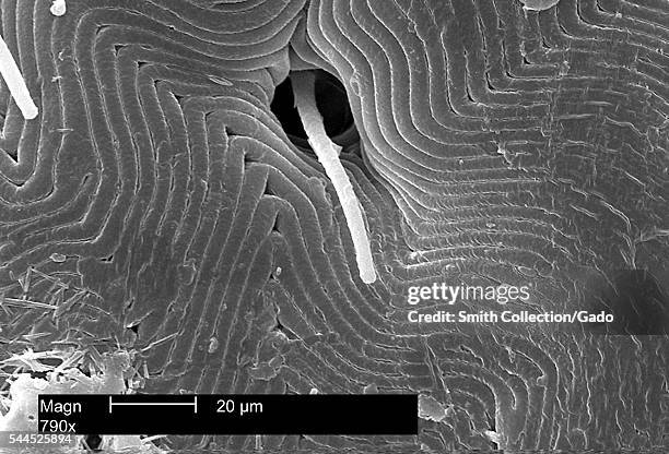 This scanning electron micrograph depicts a dorsal view of the back of an American dog tick, Dermacentor variabilis, magnified 790X, enabling you to...