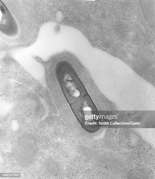 This is a transmission electron micrograph of a Listeria sp bacterium in a tissue sample, 2002. Listeria monocytogenes is the infectious agent...