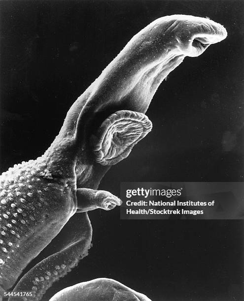 scanning electron micrograph of a schistosome parasite. - schistosoma stock pictures, royalty-free photos & images