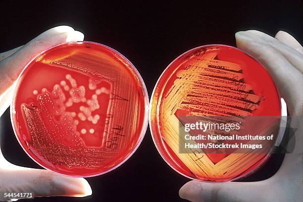 red blood cells on an agar plate are used to diagnose infection. - gram positive bacteria 個照片及圖片檔