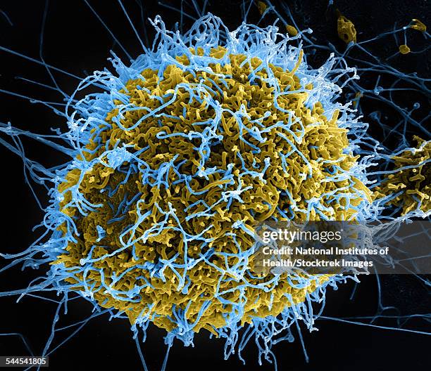 colorized scanning electron micrograph of filamentous ebola virus particles. - rna stock pictures, royalty-free photos & images