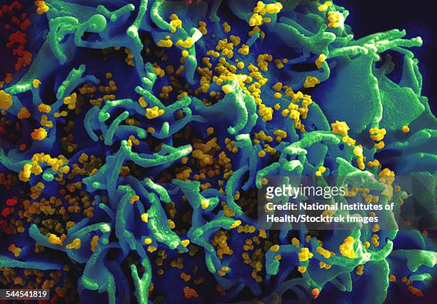 scanning electron micrograph of hiv particles infecting a human t cell. - scanning electron microscope fotografías e imágenes de stock