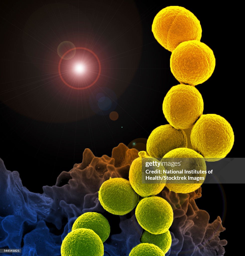 A colorized scanning electron micrograph of a white blood cell eating MRSA.