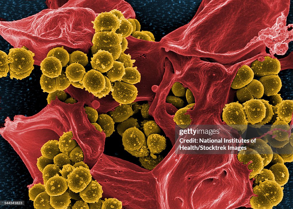 Scanning electron micrograph of Staphylococcus and a dead human neutrophil.