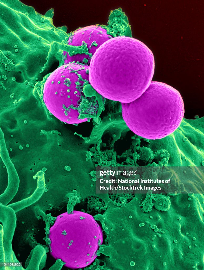 Scanning electron micrograph of a human neutrophil ingesting MRSA.