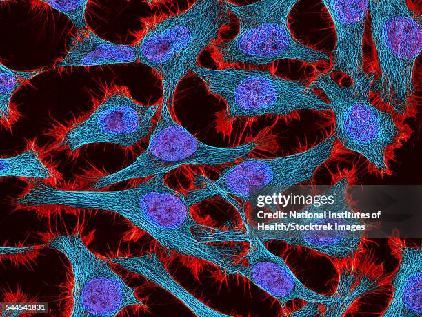 multiphoton fluorescence image of hela cells. - microfotografia immunofluorescente foto e immagini stock