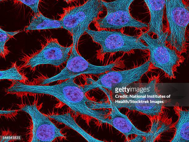 multiphoton fluorescence image of hela cells. - hela cells stockfoto's en -beelden