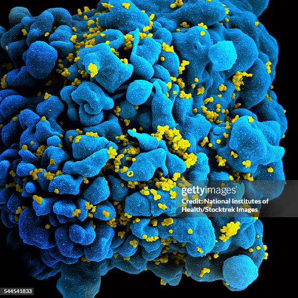 colorized image of hiv-infected h9 t-cell. - scanning electron micrograph stock pictures, royalty-free photos & images