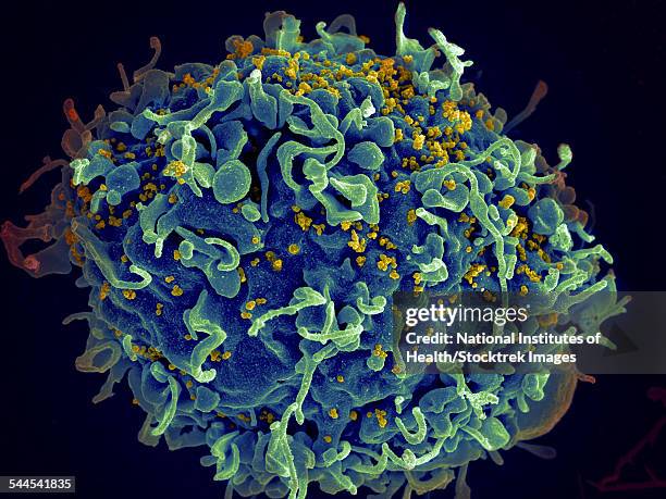 scanning electron micrograph of hiv particles infecting a human h9 t cell. - virus hiv stock-fotos und bilder