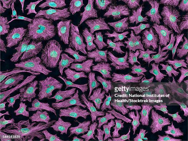multiphoton fluorescence image of hela cells. - citoesqueleto fotografías e imágenes de stock