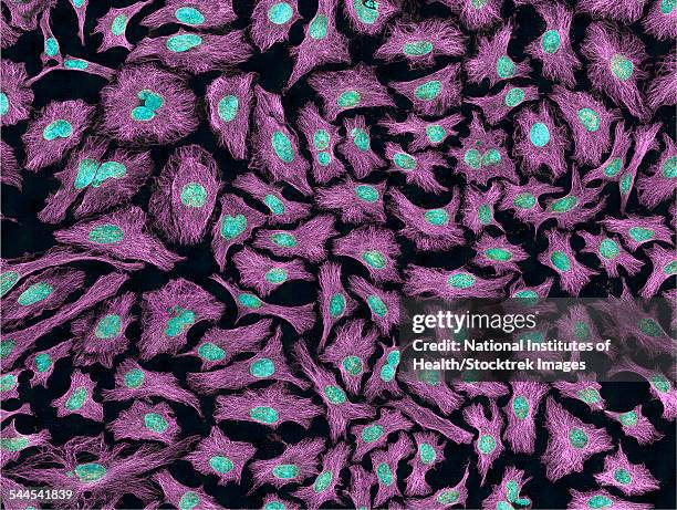 multiphoton fluorescence image of hela cells. - henrietta lacks stock pictures, royalty-free photos & images