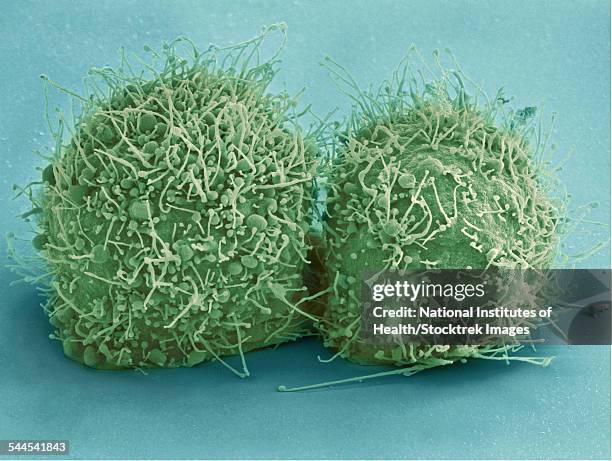 scanning electron micrograph of just-divided hela cells. - hela cells foto e immagini stock