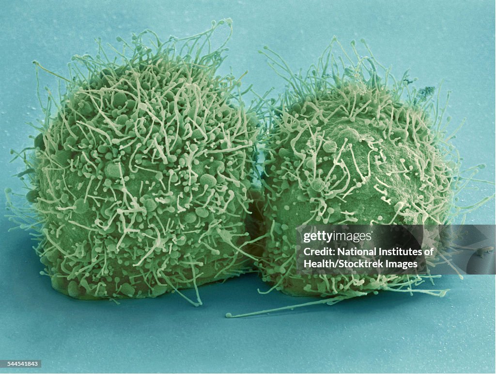 Scanning electron micrograph of just-divided HeLa cells.