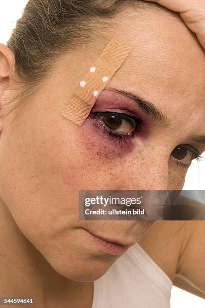 Medizin, Frau mit blauem Auge und Pflaster-