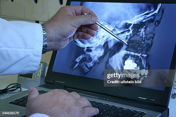 Medizin, Röntgen, Röntgenbild eines Schädels auf einem Computerbildschirm