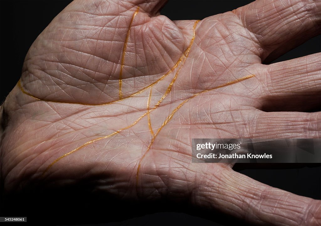 Hand with old life lines