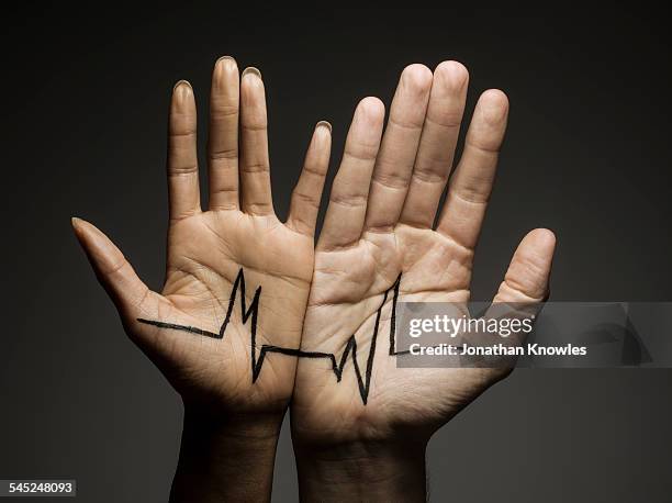 two hands connected by a dramatic graph - heart beat stock pictures, royalty-free photos & images