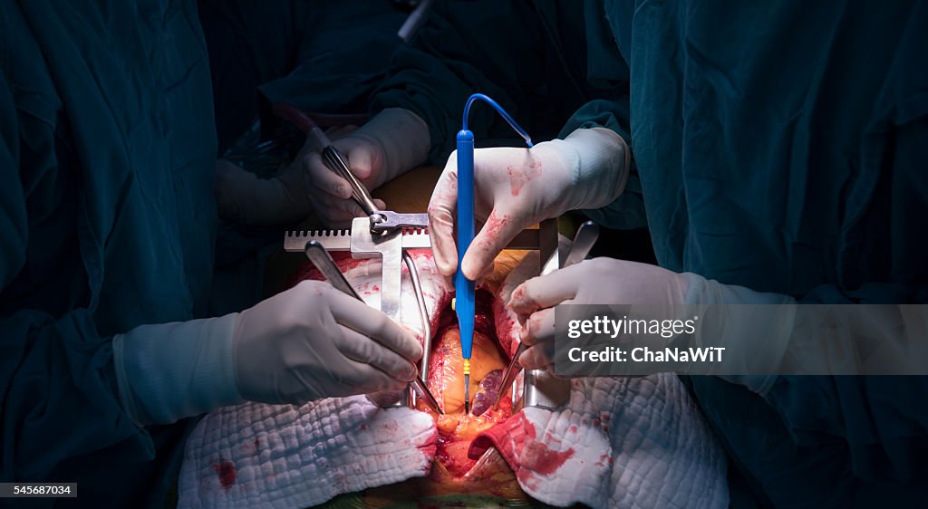 Open heart surgery