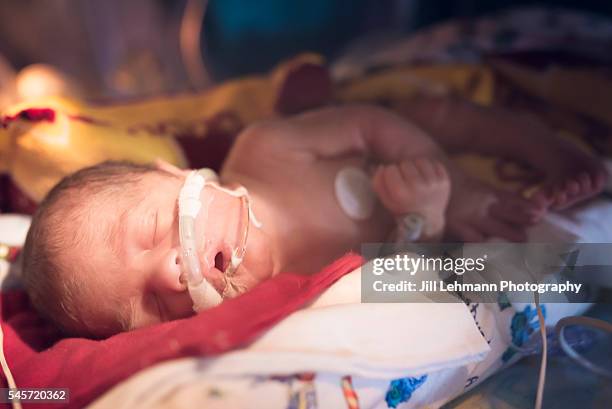 premature baby in nicu sleeps in his isolette - attrezzatura per la respirazione artificiale foto e immagini stock