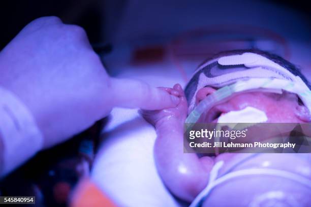 premature baby in nicu sleeps in his isolette - bilirubina foto e immagini stock