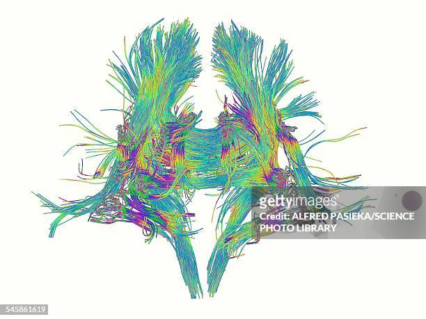 white matter fibres of the human brain - neurons brain stock illustrations