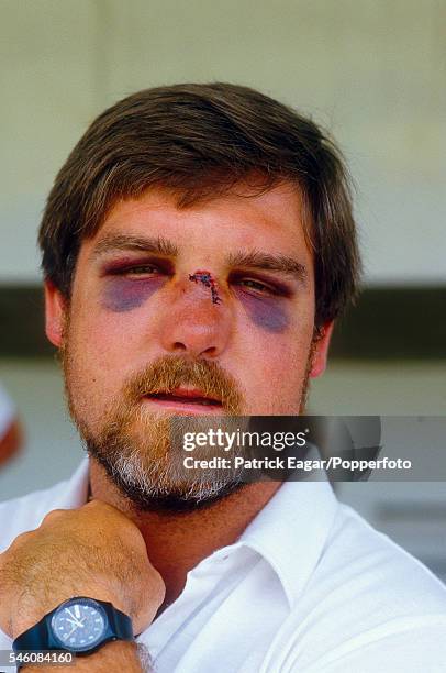 Mike Gatting has to sit out the 1st Test match between West Indies and England at Sabina Park, Kingston, Jamaica, due to injury suffered after being...