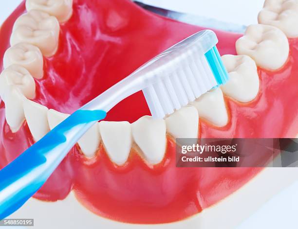 Dentist, model of a denture with tooth brush