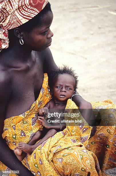 Cameroon: A woman with an undernourished child. -