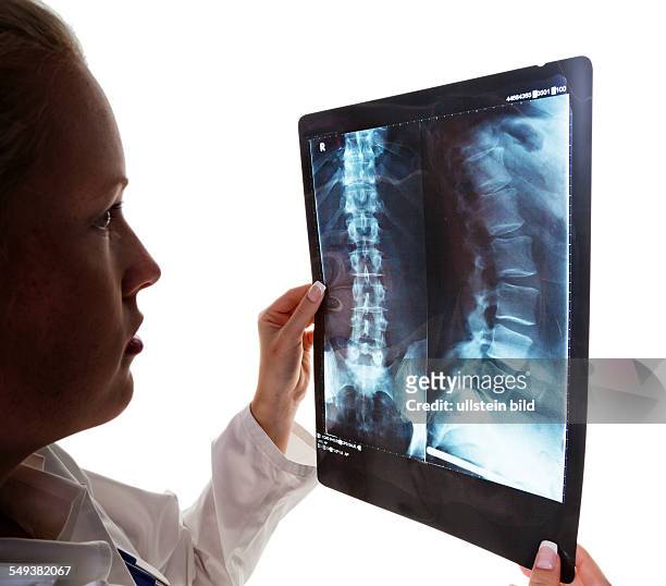Eine junge Ärztin mit Röntgenaufnahme