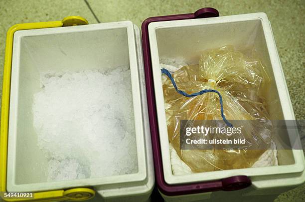 Germany, Bochum: transplantation of organs in a hospital in Bochum. A heart in a cold box.