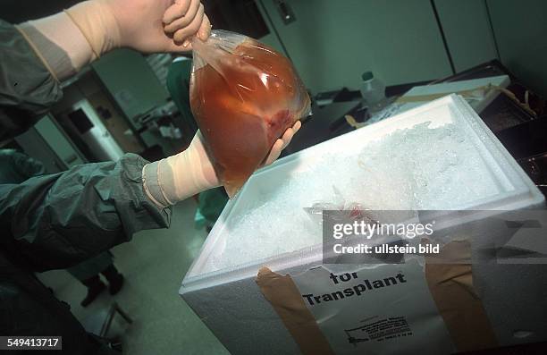 Germany, Essen: transplantation of organs in a hospital in Essen.