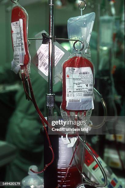 Germany, Essen: transplantation of organs in a hospital in Essen. Blood conserves.