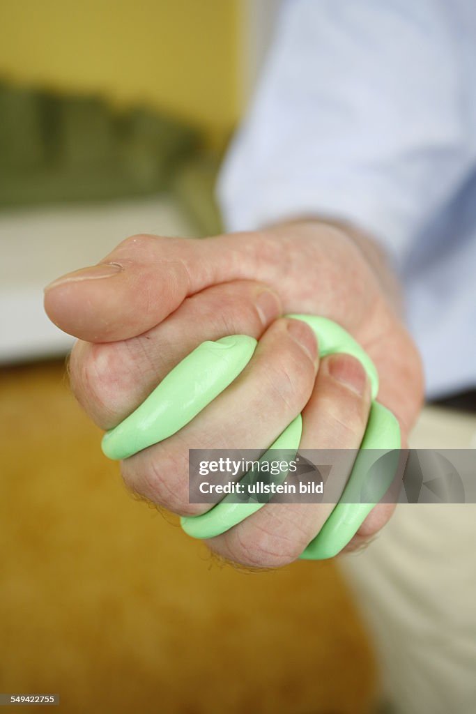 DEU, Germany: Therapy plasticine. A patient during the therapy for the hands with plasticine.