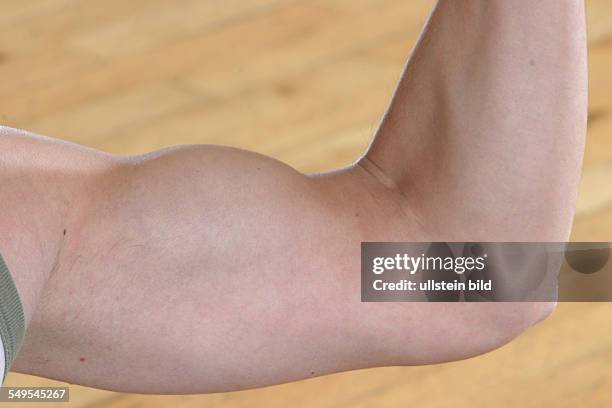 Strained upper arm of a young man.