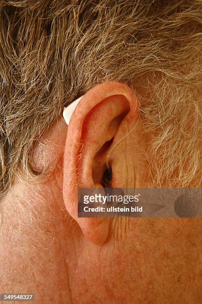 Bonn: Living in old age: Presbycusis, or age-related hearing loss, hearing aid, hearing instrument