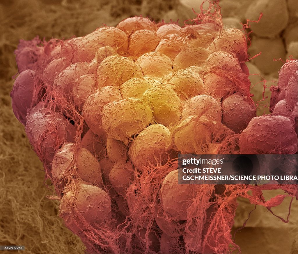 Fat tissue, SEM