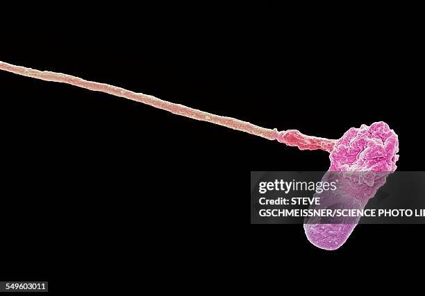 abnormal human sperm cell, sem - electron micrograph stock illustrations
