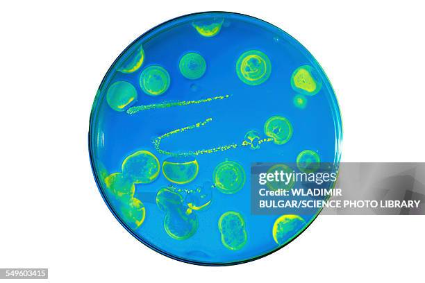 bacteria growing in a petri dish - boîte de pétri photos et images de collection