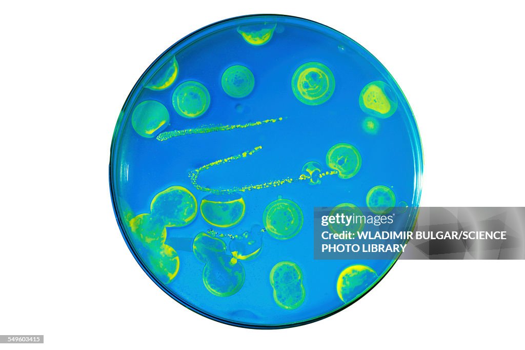 Bacteria growing in a petri dish