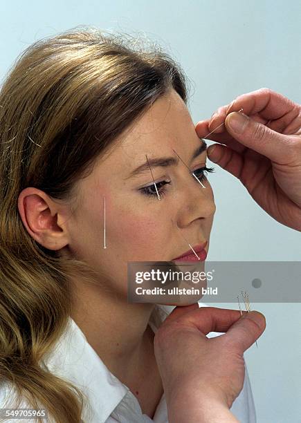 Dr. Giac Nguyen, Heilpraktiker, Akupunkteur aus Vietnam, mit Patientin, Setzen von Akupunkturnadeln im Gesicht, alte asiatische Heilmethode, Muenchen,