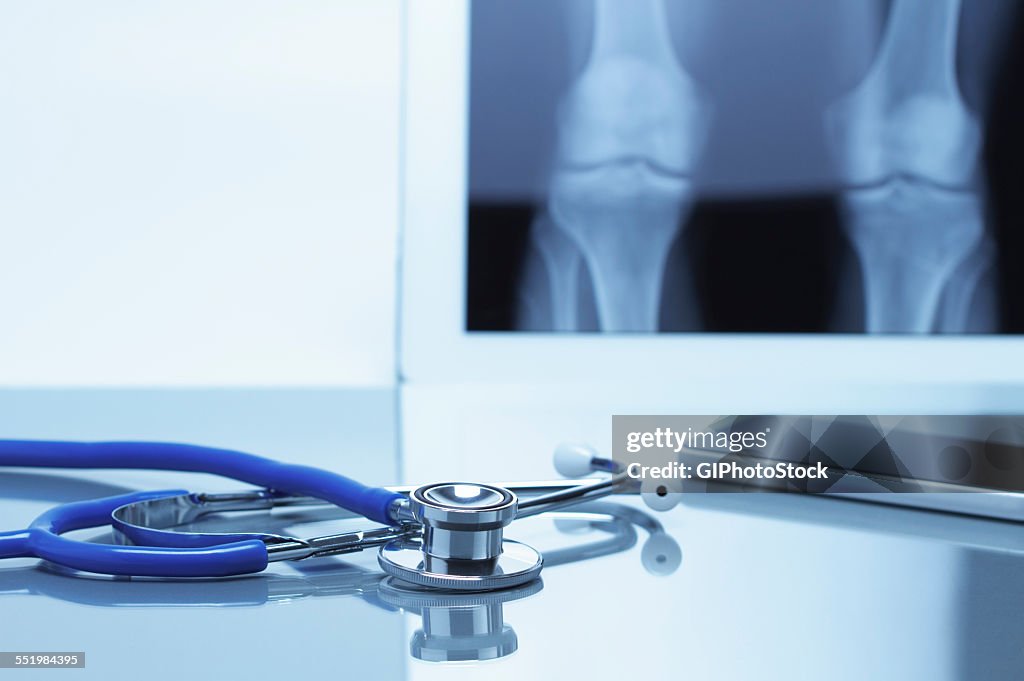 Acoustic stethoscope and smartphone on office desk with digital tablet displaying knee xray