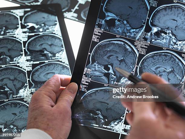 close up of doctor viewing a healthy brain scan - sistema nervoso centrale foto e immagini stock