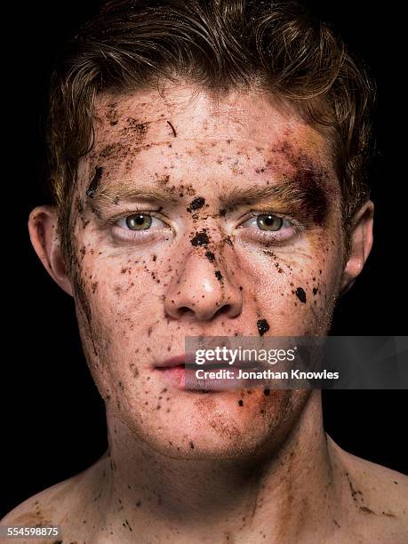 man's face with mud splattered and bruises - aanvallen sporten stockfoto's en -beelden