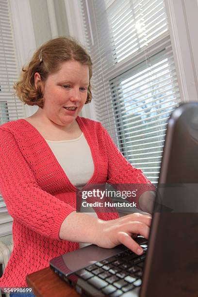 young woman with autism using her laptop - hemangioma - fotografias e filmes do acervo