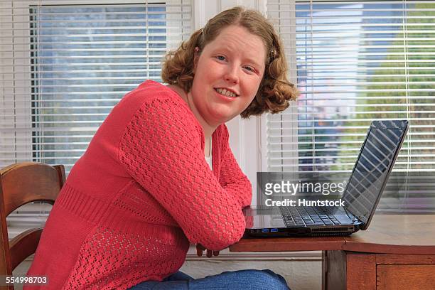 young woman with autism using her laptop - hemangioma - fotografias e filmes do acervo