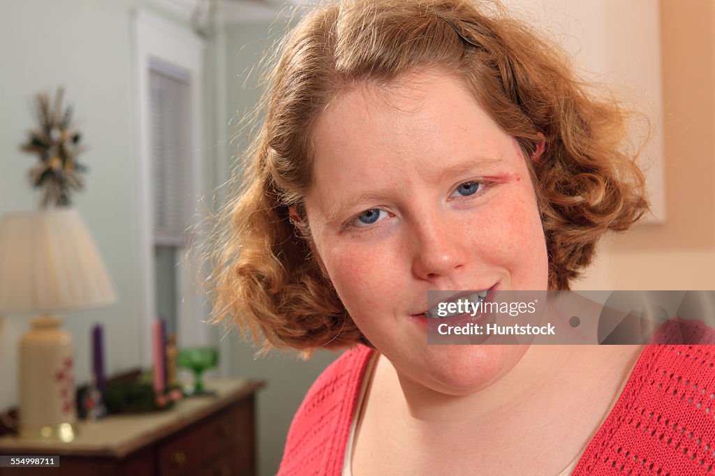 Smiling portrait of a young woman with Autism