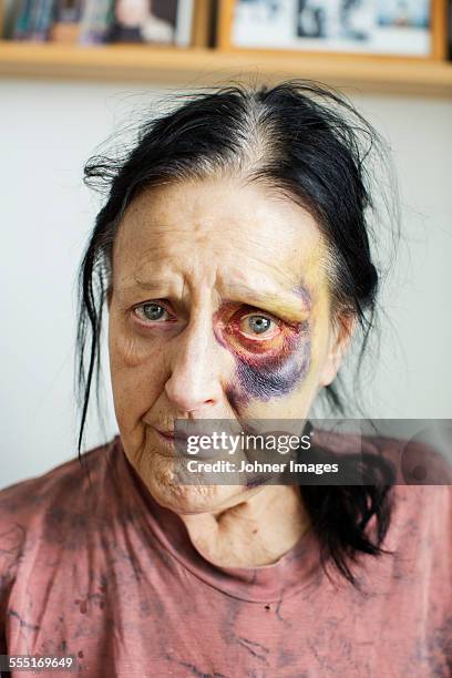 portrait of senior woman with bruises on her face - portrait looking down stock pictures, royalty-free photos & images