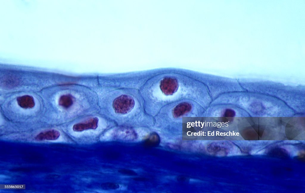 Transitional Epithelium (unstretched state), 250X