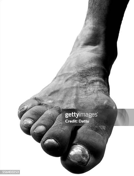 ballet dancers foot - ballet feet hurt stock pictures, royalty-free photos & images